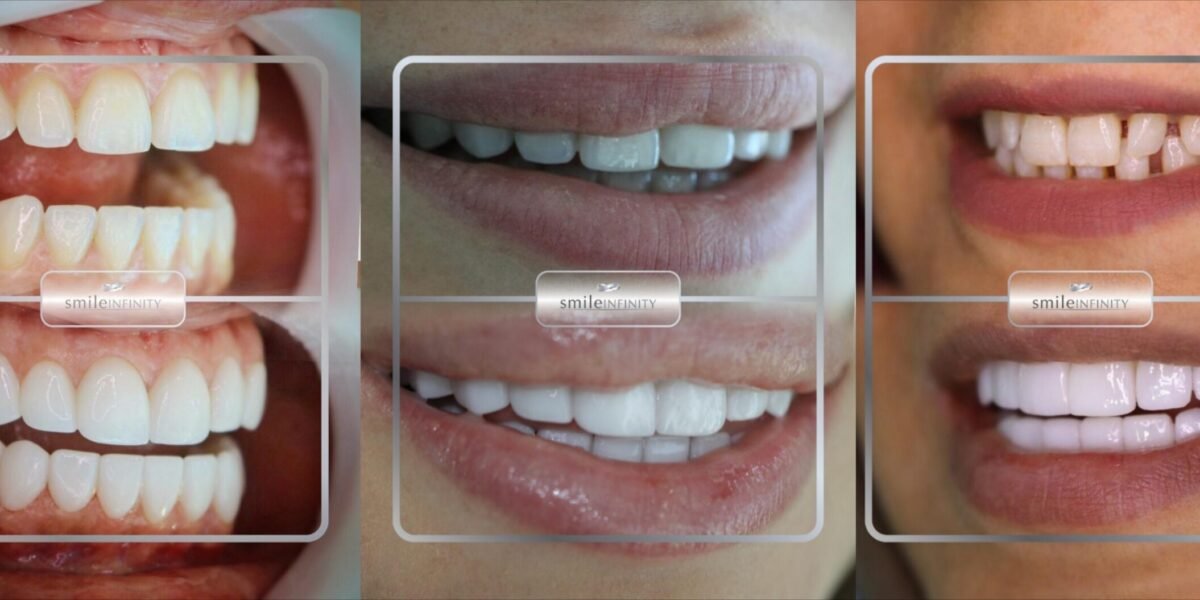 عيادة الدكتور حبيب ظريفه Ferrari Dental Clinic by Smile Infinity سبيلك الفريد للحصول على ابتسامة ساحرة